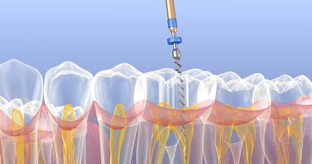 Endodontie